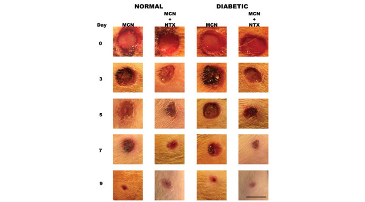 wound healing in diabetic patients